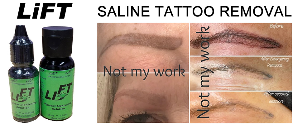 Eyebrow Tattoo and Microblading Removal  Norwich